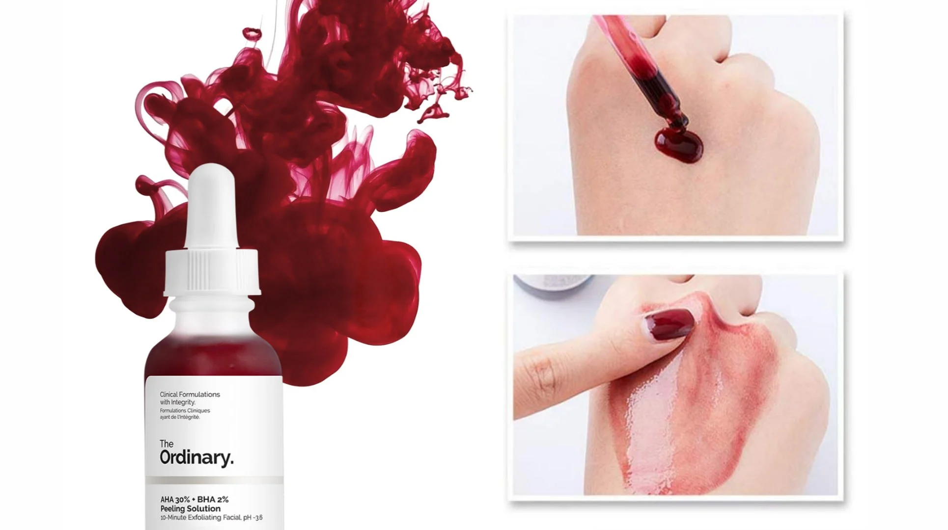 سرم پیلینگ اوردینری